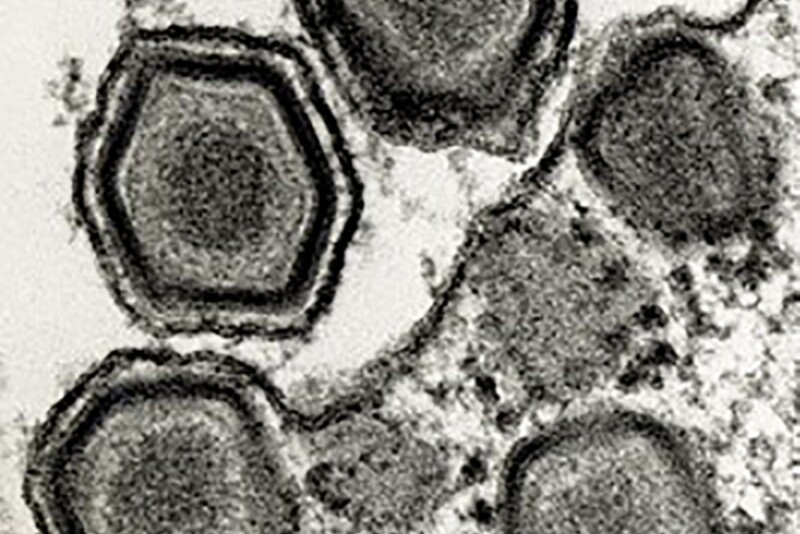 Các chuyên gia thú y về dịch bệnh của EU đánh giá sự bùng phát dịch tả lợn châu Phi ở Tây Ban Nha.